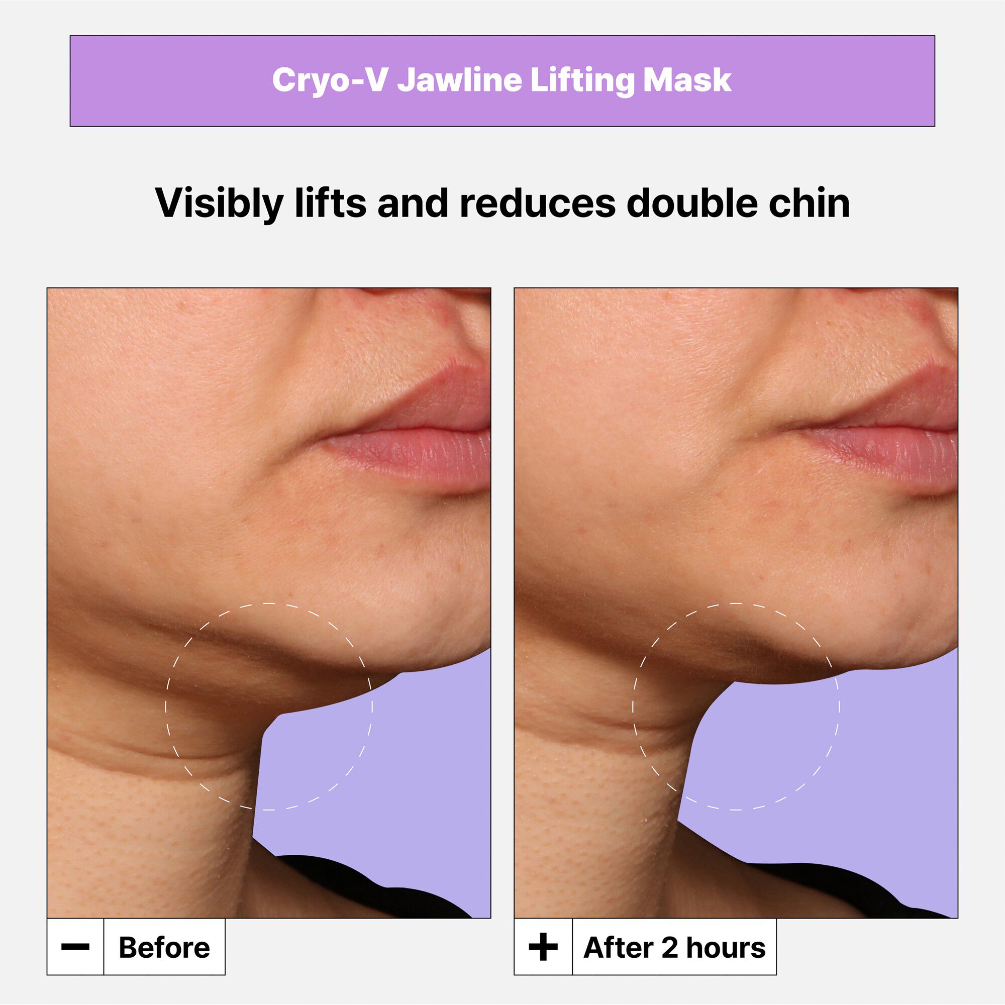 Cryo V-Sculpt Jawline Lifting Mask