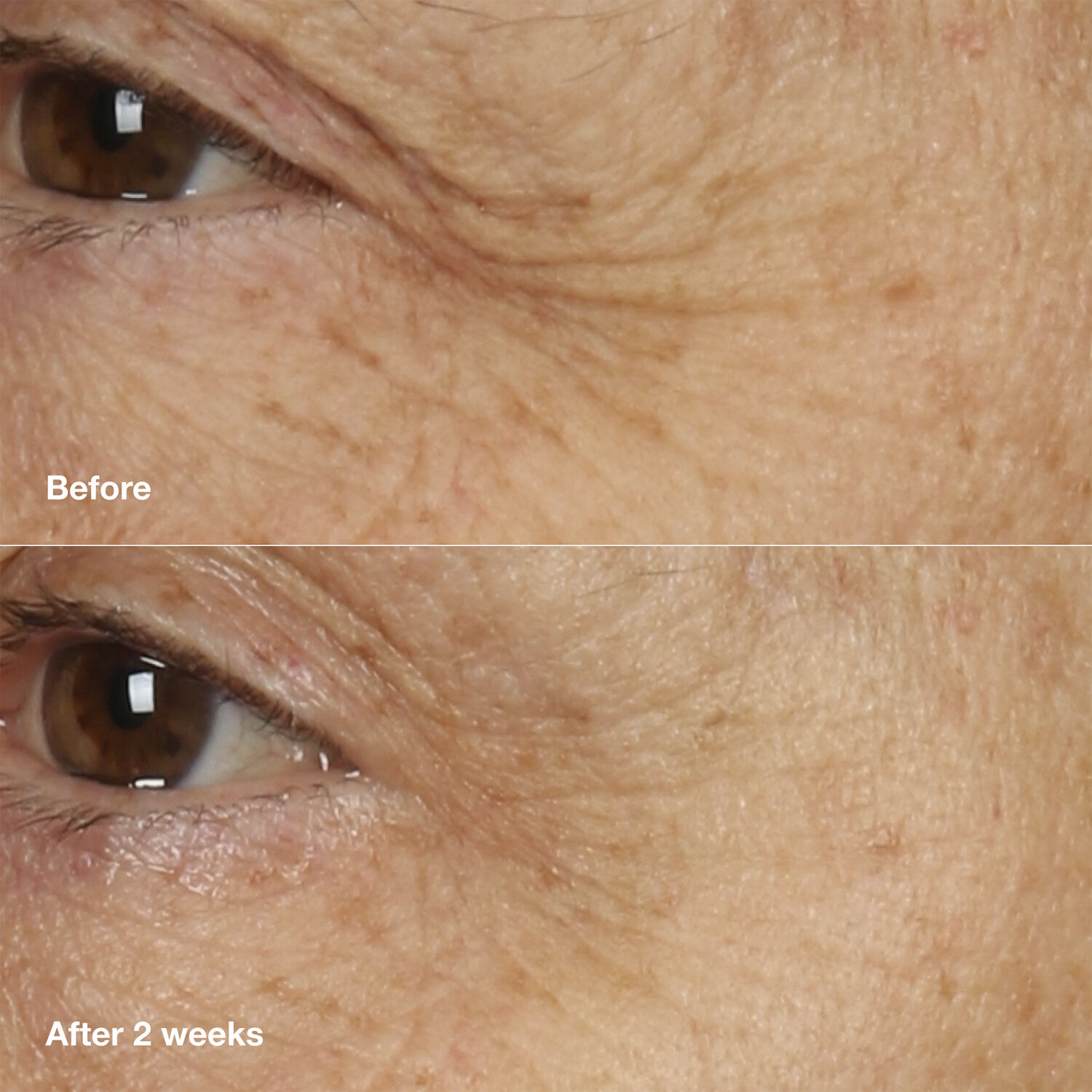 Smart Clinical Repair Overnight Recovery Cream and Mask