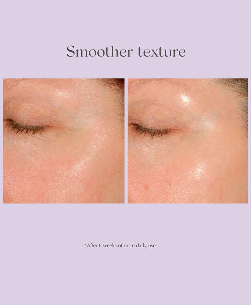 Daily Resurfacing Peel