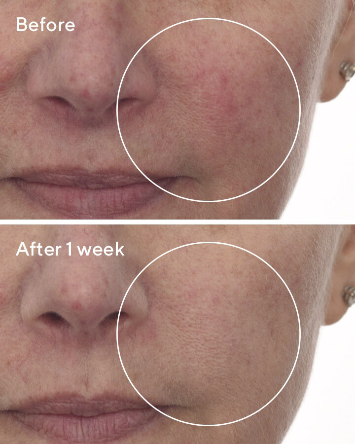 CELLULAR HYDRATION REPAIR SERUM 30 ML