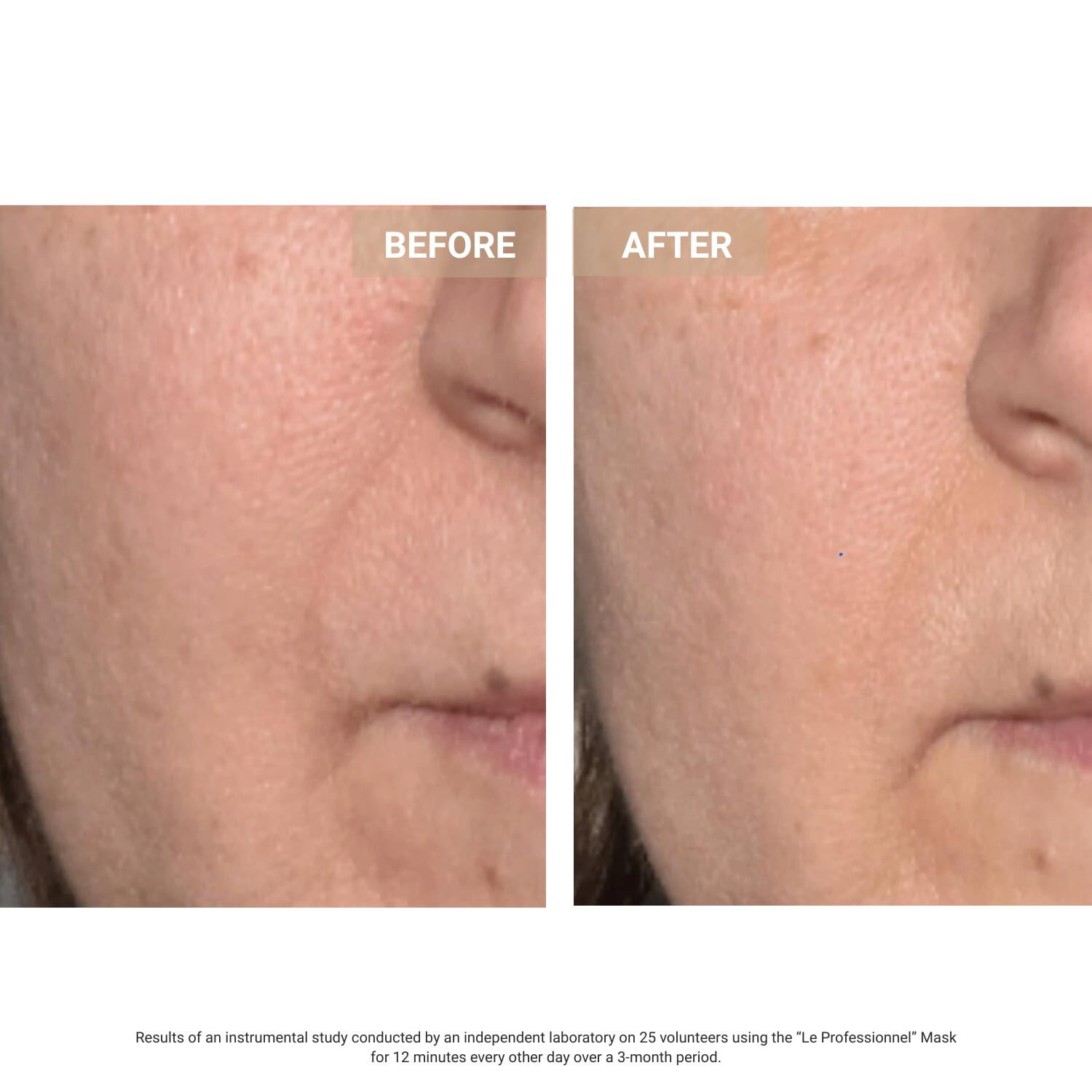 Anti-Aging LED Face Mask The Professional - Anti-age LED-ansigtsmaske