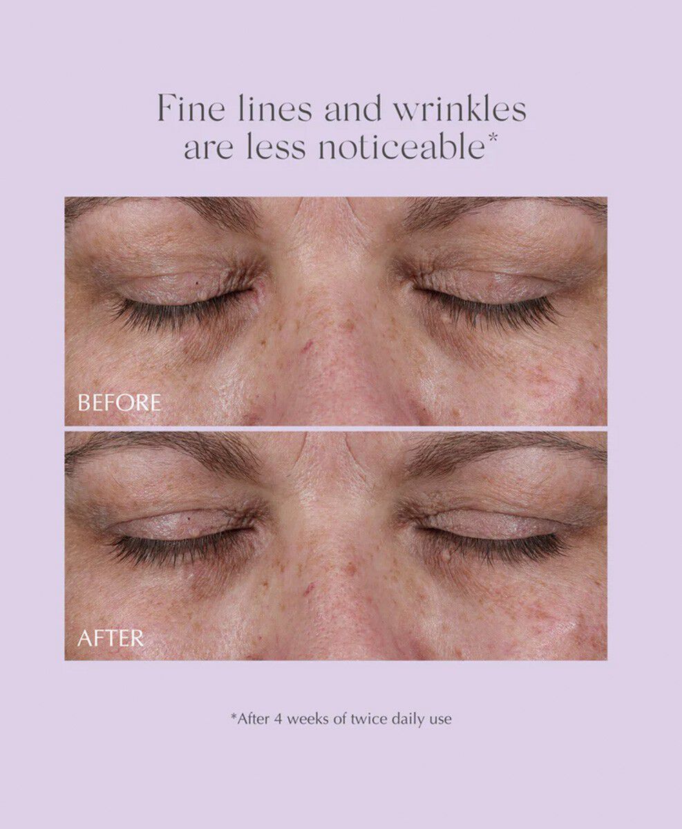 Age Reverse Eye Contour