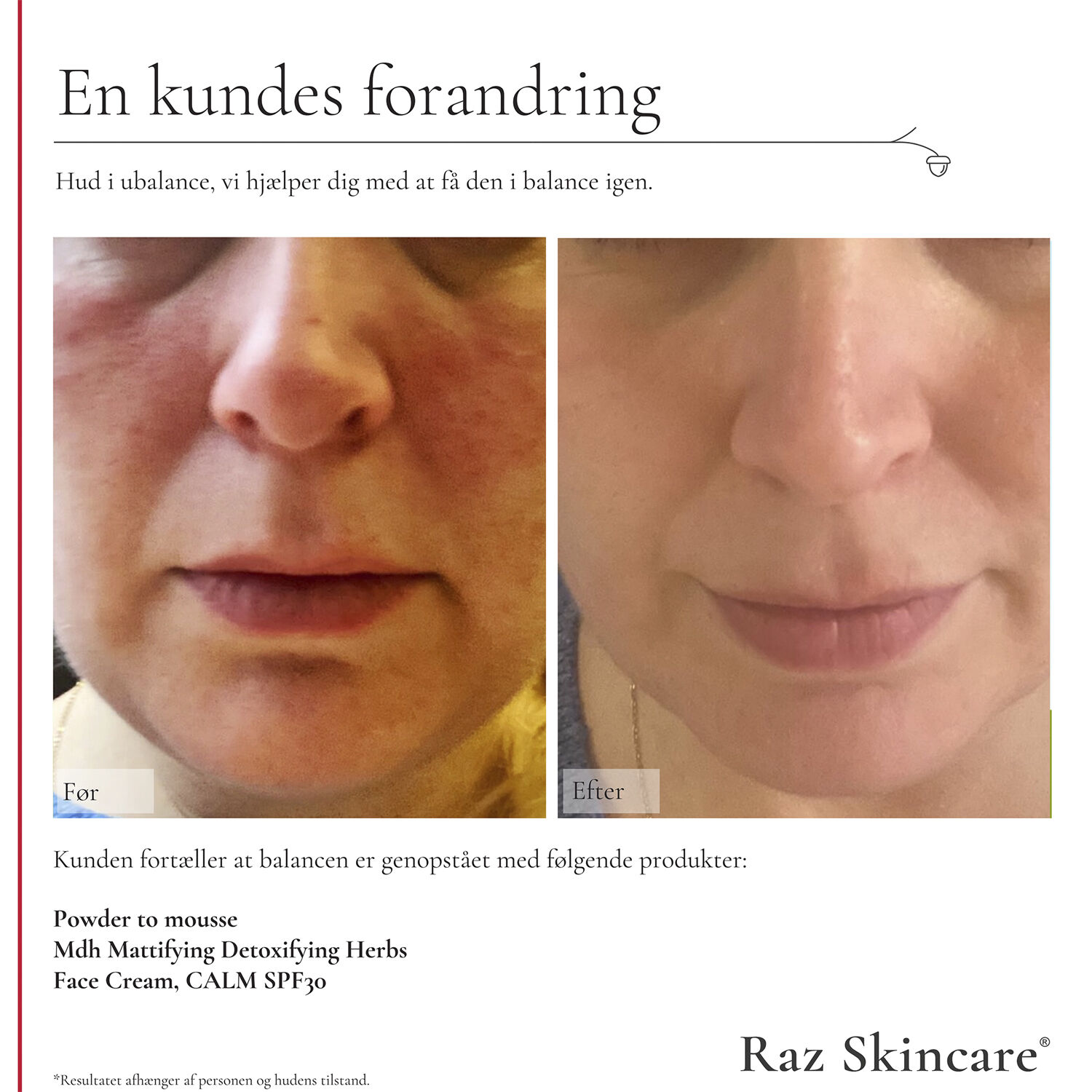 Raz Skincare Face Cream, CALM 50 ml