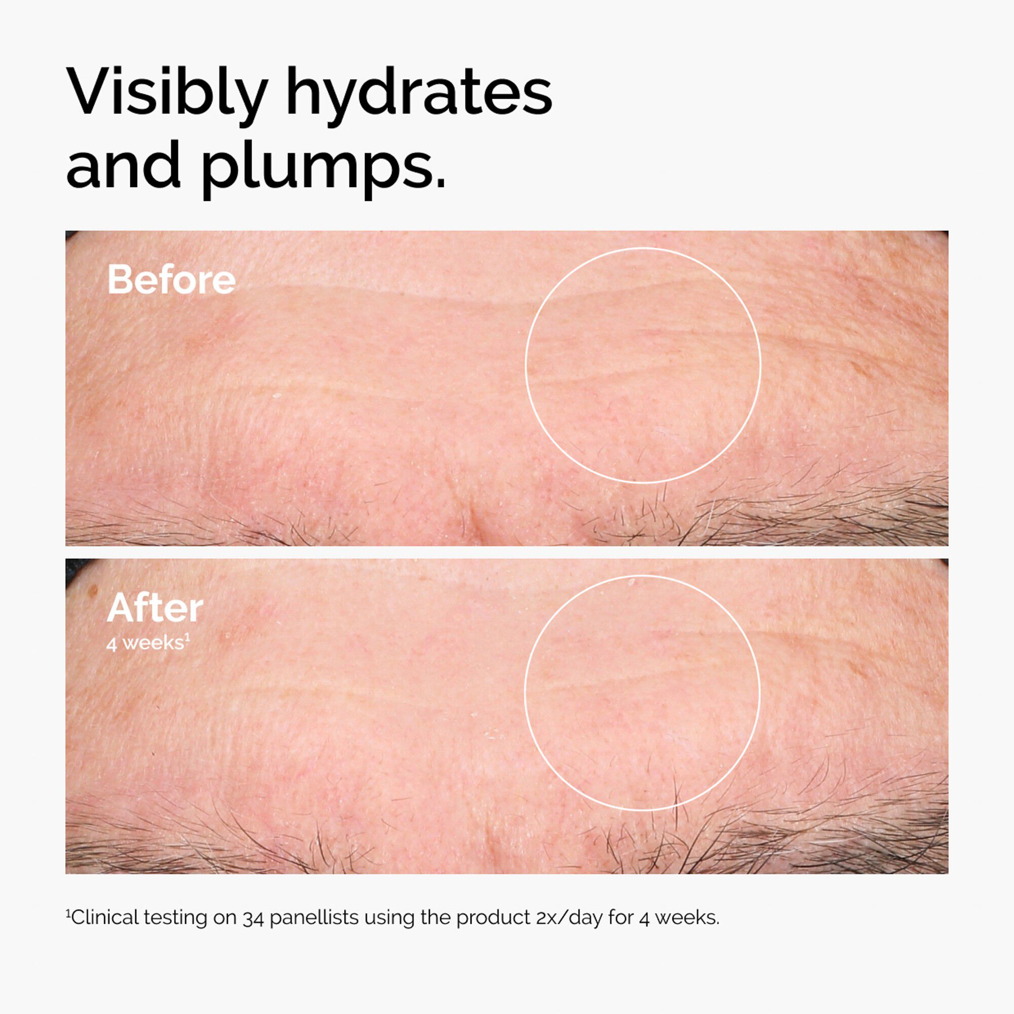 Hyaluronic Acid 2% + B5