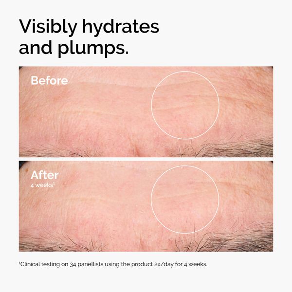 Hyaluronic Acid 2% + B5