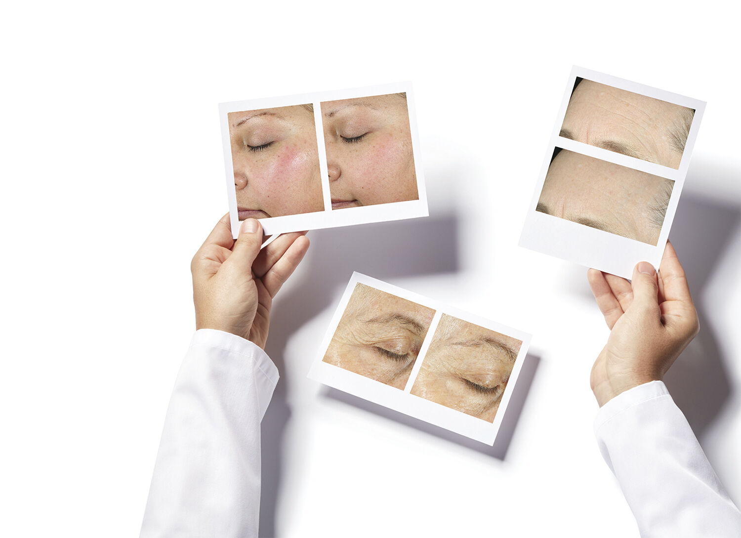 Intense Recovery Cream