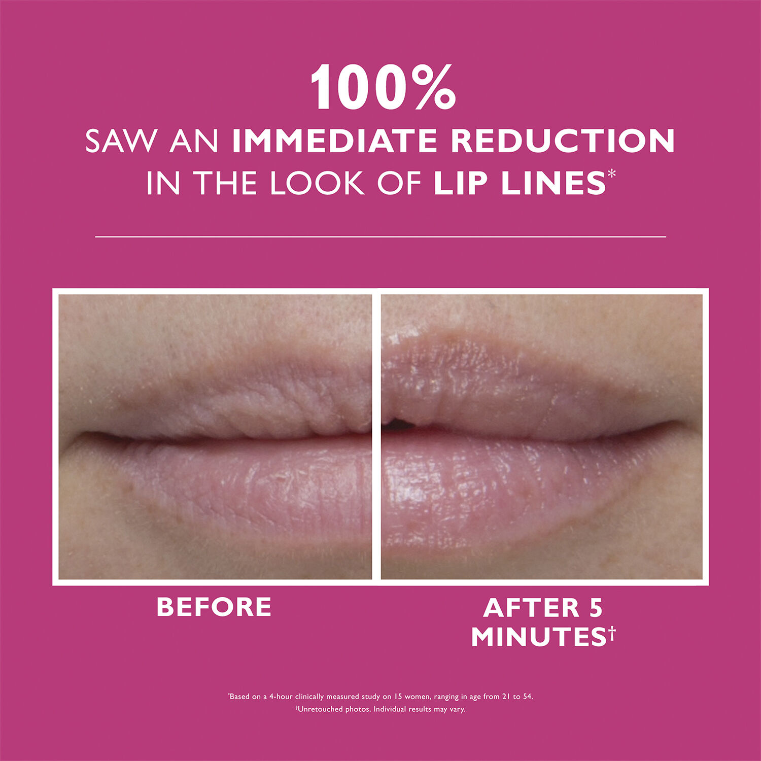 Peter Thomas Roth Instant FIRMx&reg; Lip Filler 10 ml