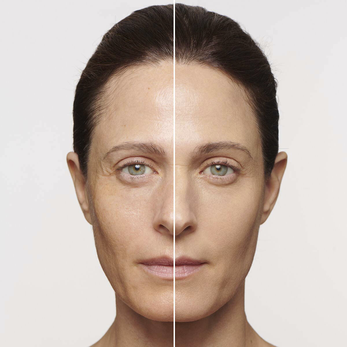 SOS Primer Imperfections