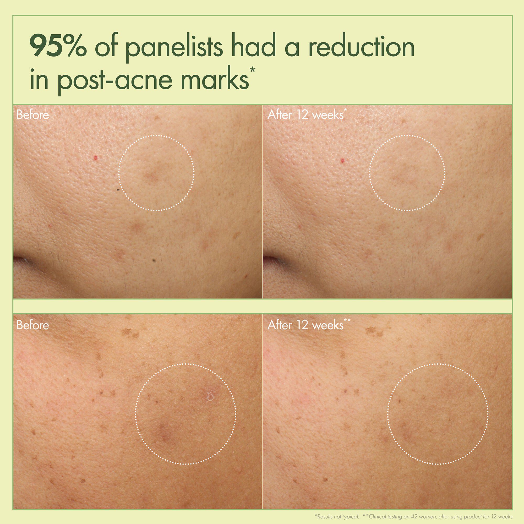 Dr. Weil Mega-Mushroom Dark Spot Correcting Brightening Moisturizer