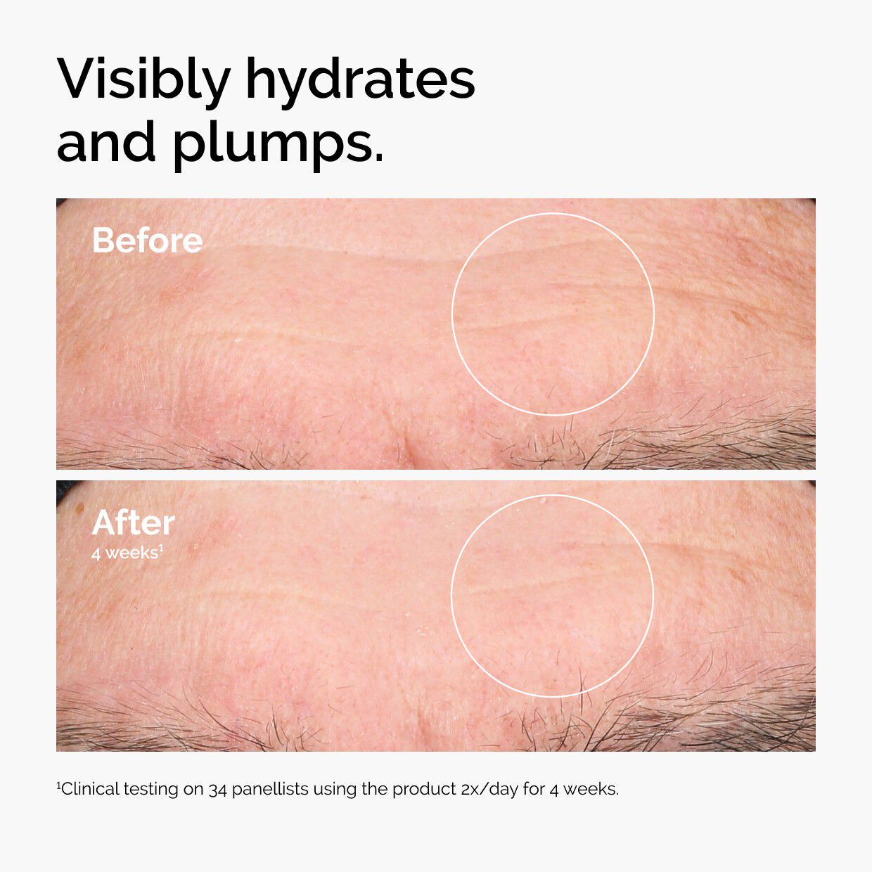 HYALURONIC ACID 2%+ B5 120ML/4. 1FL
