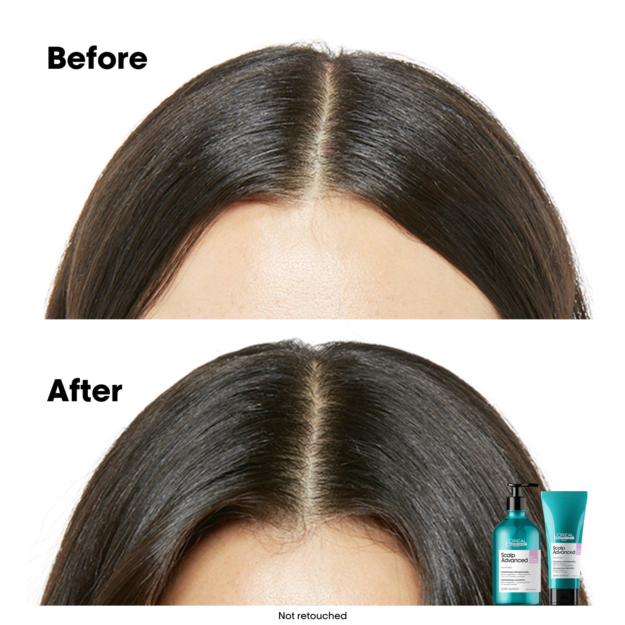 L'Or&eacute;al Professionnel Scalp Advanced Anti-Discomfort Treatment 200ml