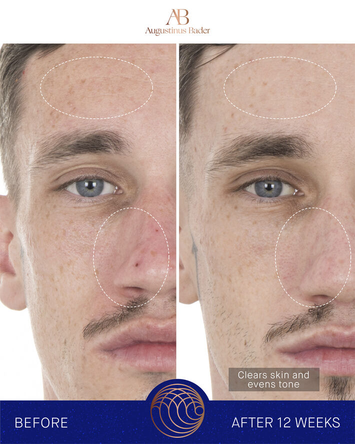 The Retinol Serum 15ml Nomade ROW