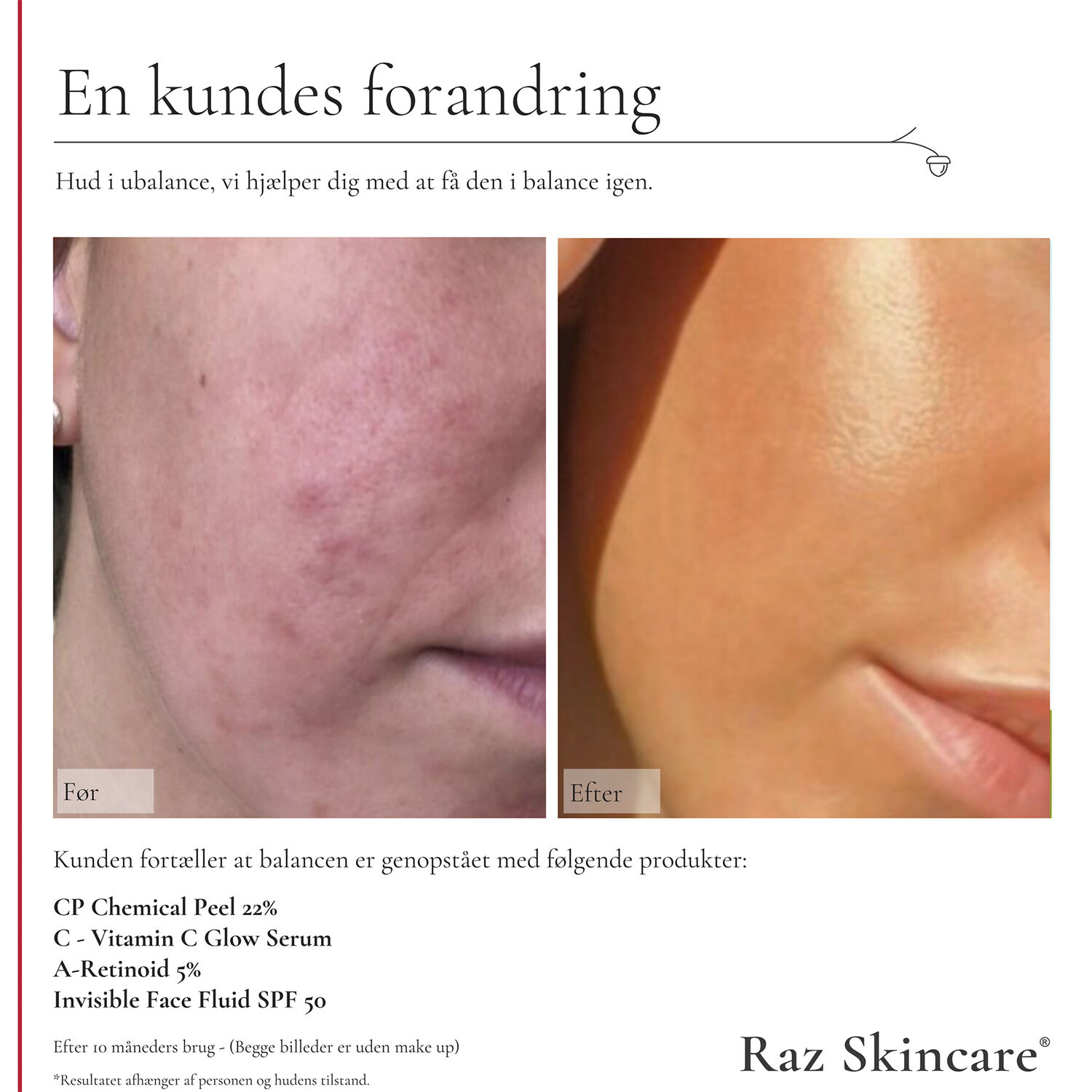 Raz Skincare A-Retinoid 5% 30 ml