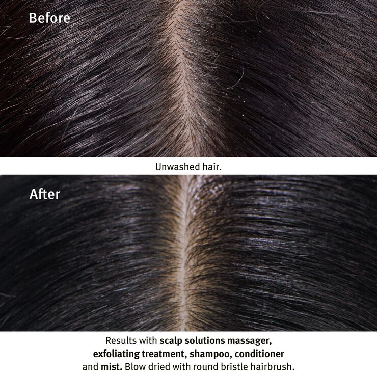 Scalp Solutions Stimulating Scalp Massager