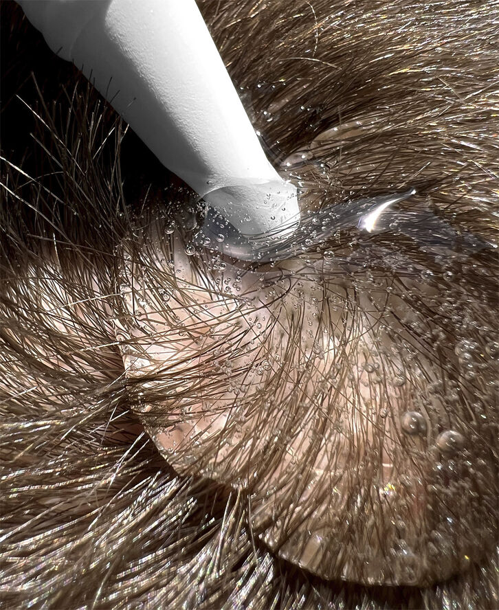 Hair Activator - Hårstimulerende serum