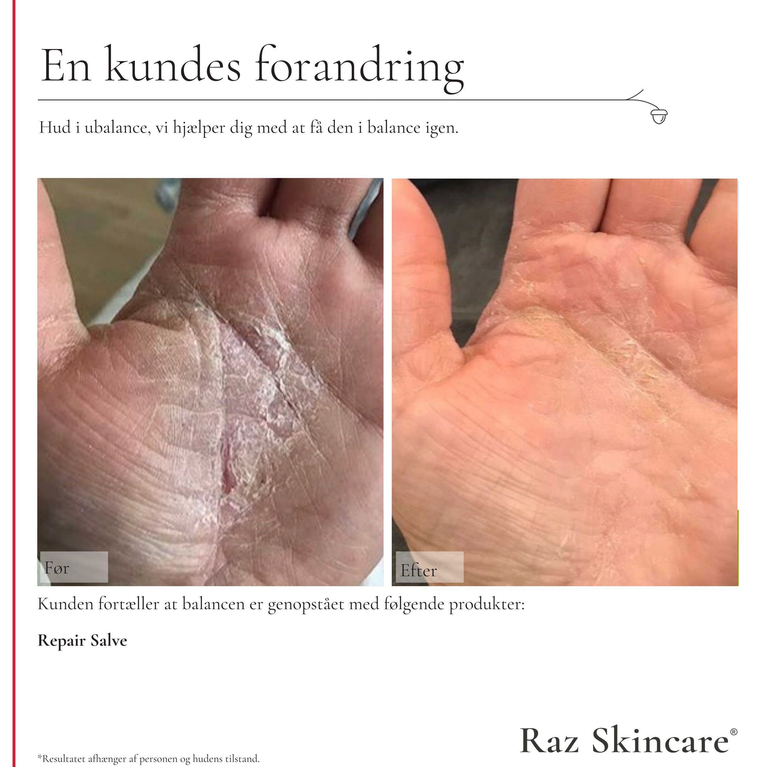 Raz Skincare Repair Salve Perfume Free 100 ml