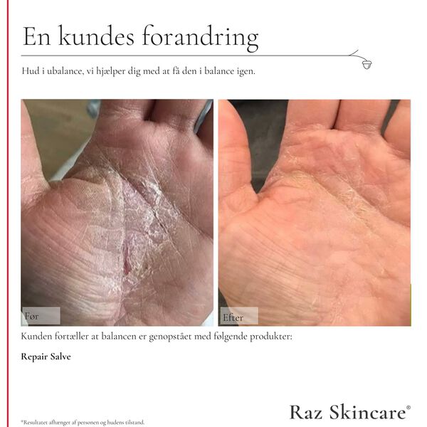 Raz Skincare Repair Salve Perfume Free 100 ml