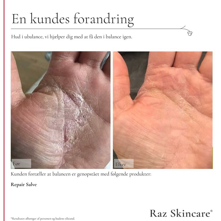 Raz Skincare Repair Salve Perfume Free 100 ml