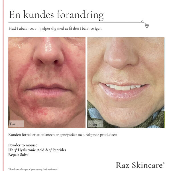 Raz Skincare Hh 3*Hyaluronic Acid & 3*Peptides 30 ml