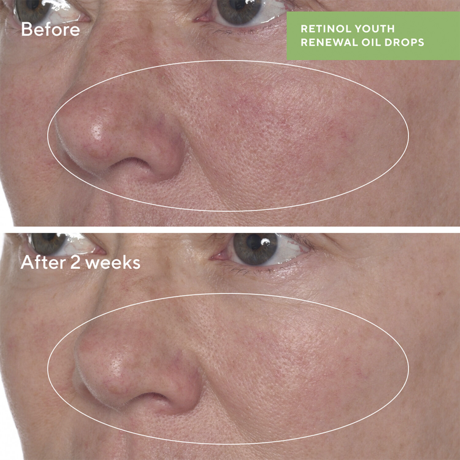 RETINOL YOUTH RENEWAL OIL DROPS 30 ML