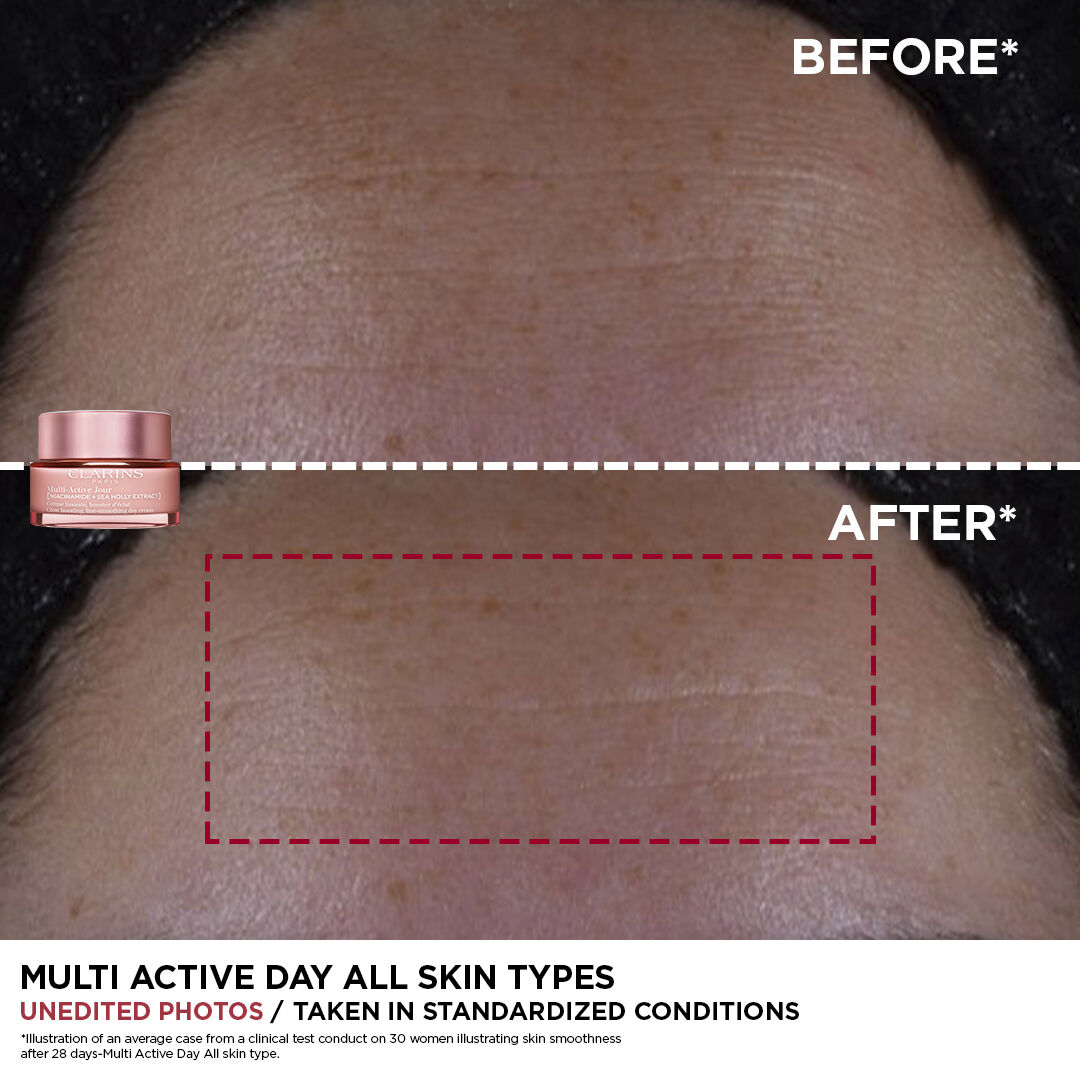 Multi-Active Dagcreme Normal/Dry Skin