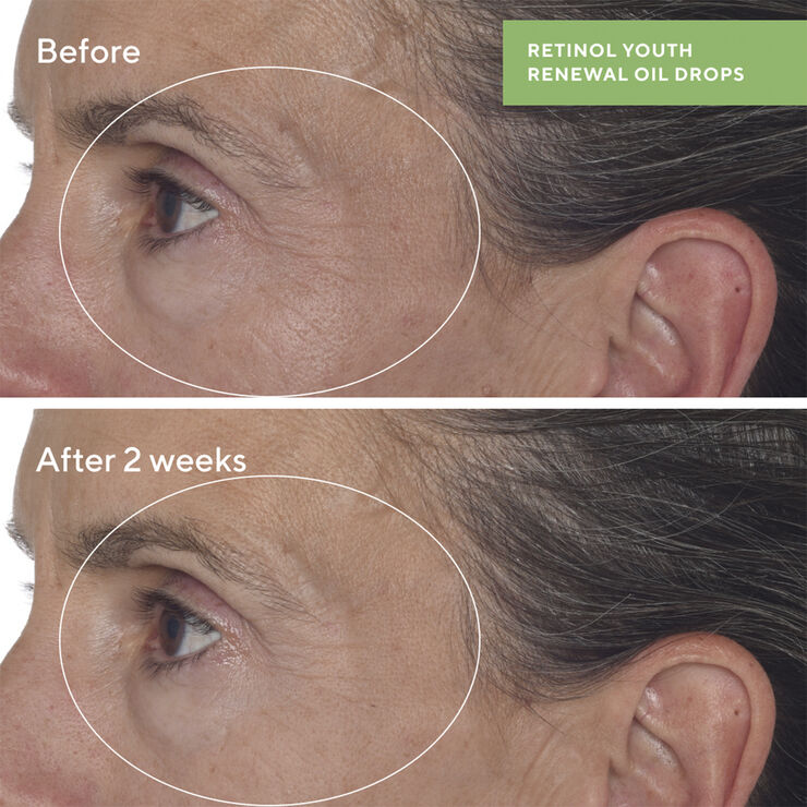 RETINOL YOUTH RENEWAL OIL DROPS 30 ML