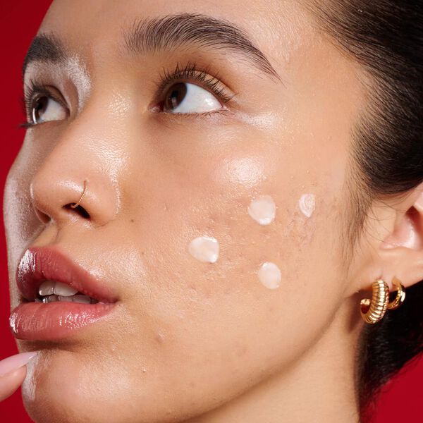 The Spot Stop : Løsning med AHA + PHA mod urenheder