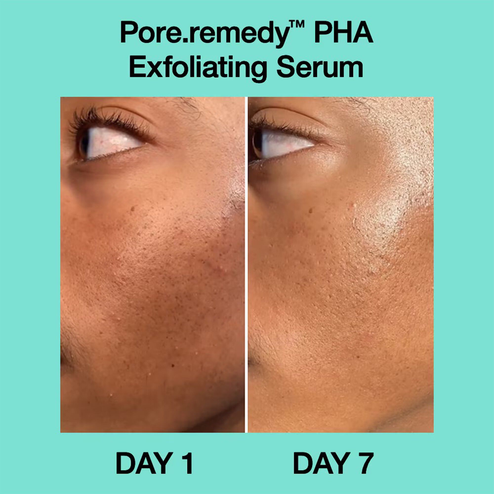 Pore&middot;remedy PHA Exfoliating Serum