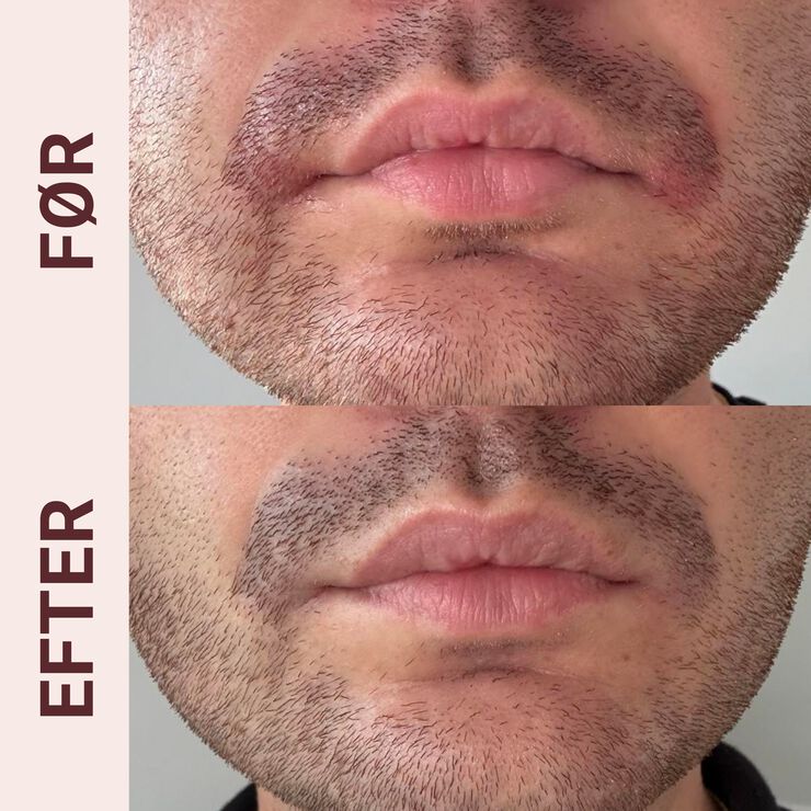 Pudderdåserne Skæl serum