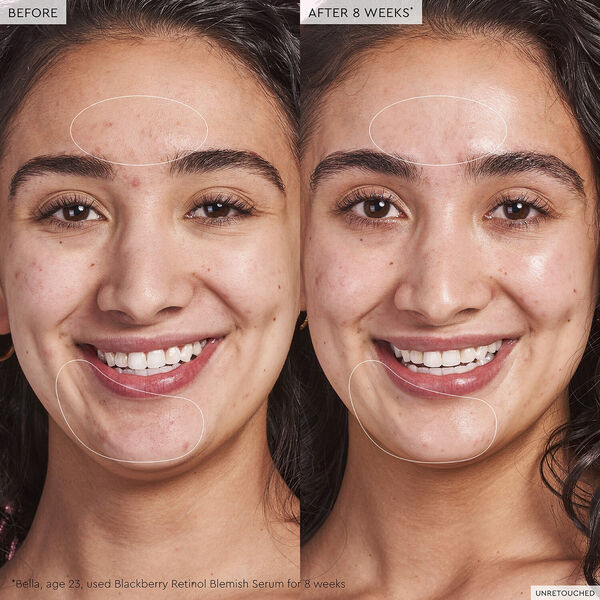 Blackberry Retinol - Reset serum