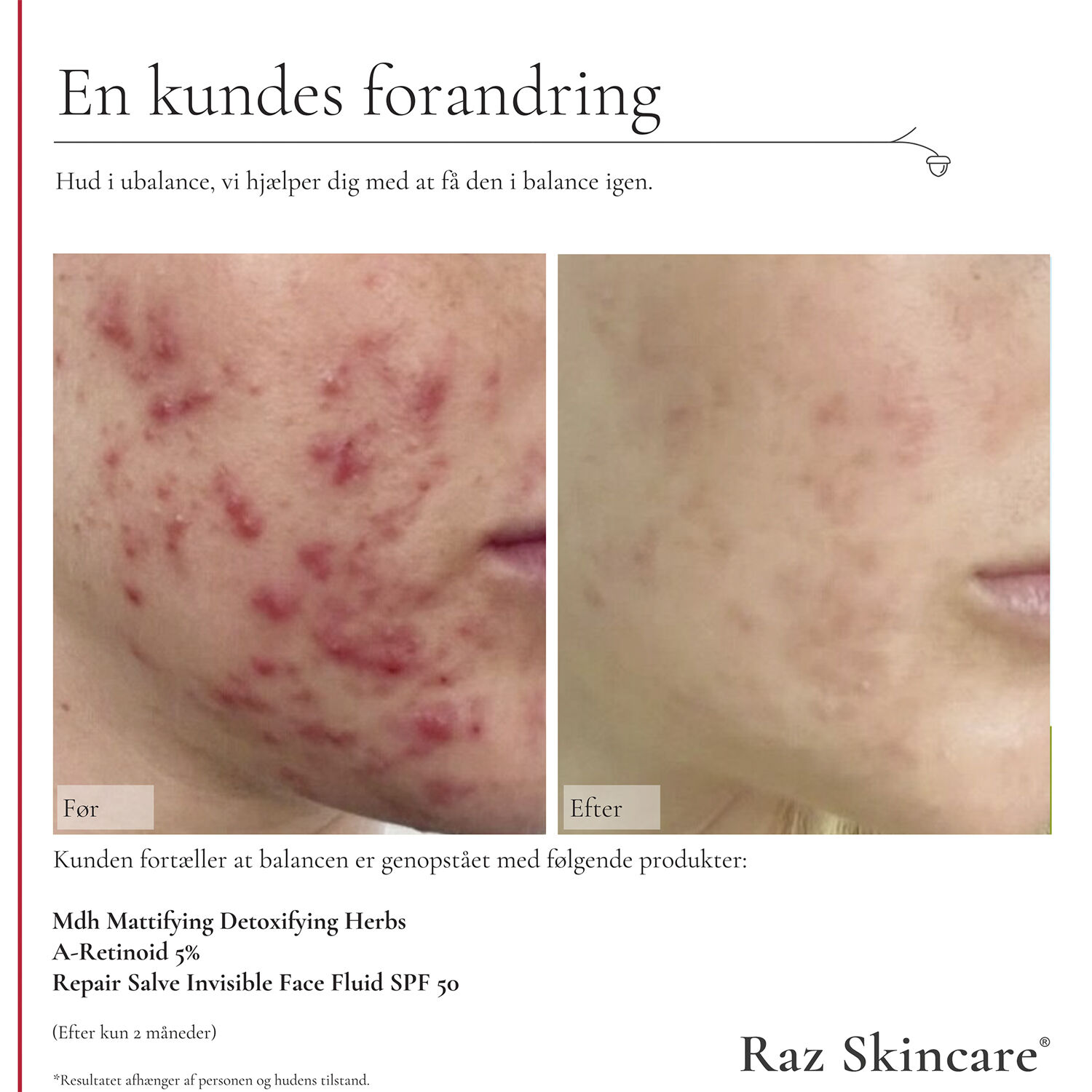 Raz Skincare Mdh Mattifying Detoxifying Herbs 30 ml