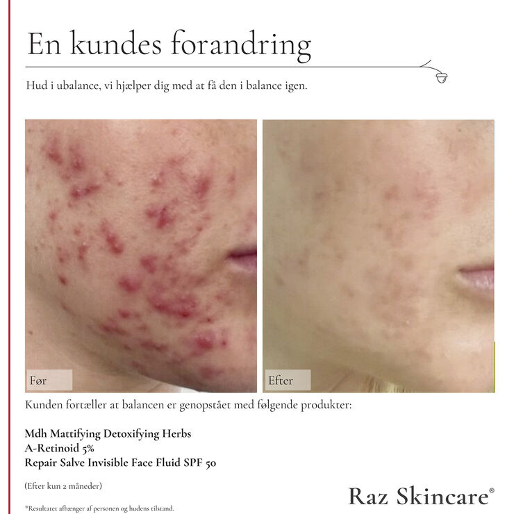 Raz Skincare Mdh Mattifying Detoxifying Herbs 30 ml