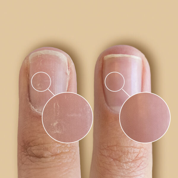 SolarOil Nail Care 14,78 ml.