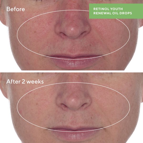 RETINOL YOUTH RENEWAL OIL DROPS 30 ML