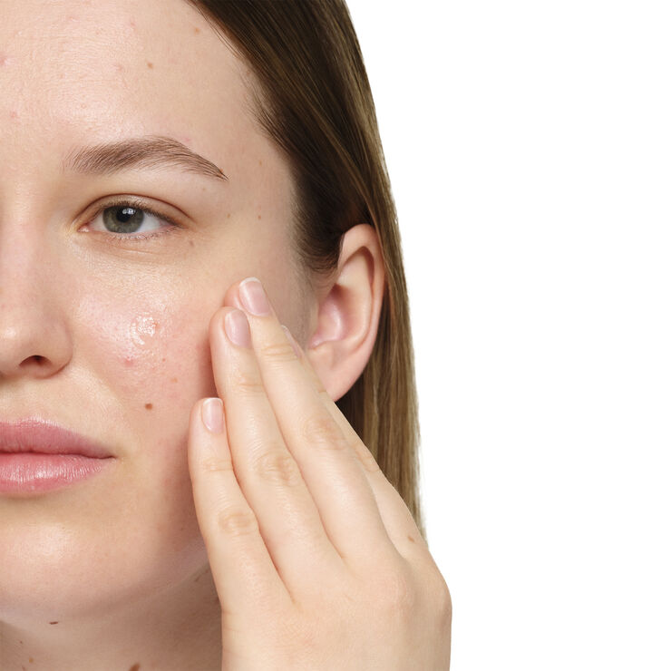 Salicylic Acid 2% Anhydrous Solution