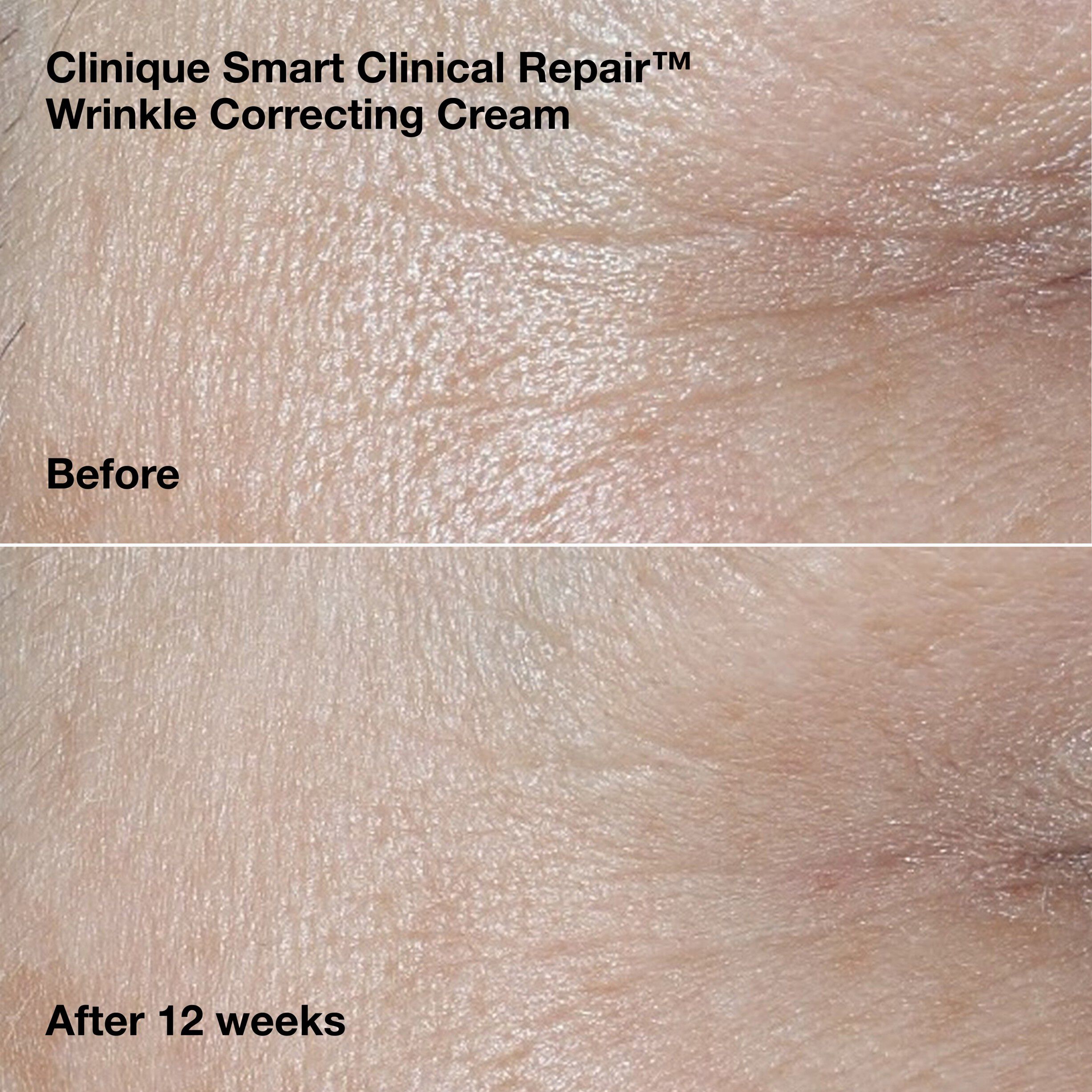 Wrinkle-Correcting Routine Set