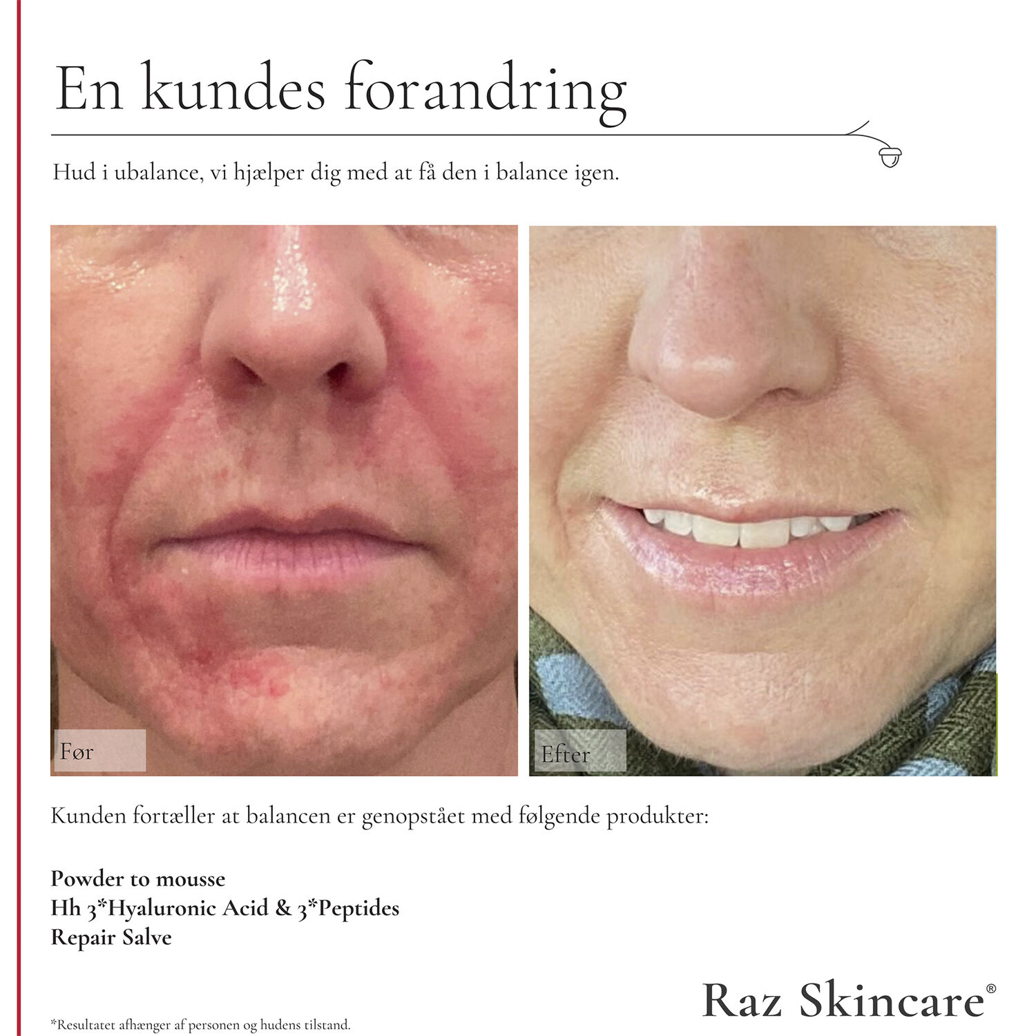 Raz Skincare Powder to Mousse 50 g