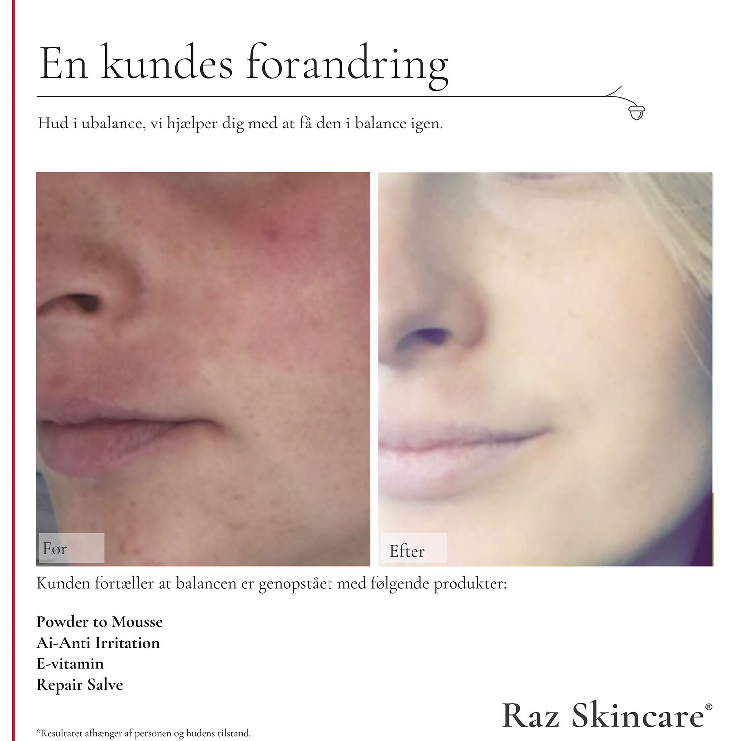 Raz Skincare Repair Salve 15 ml