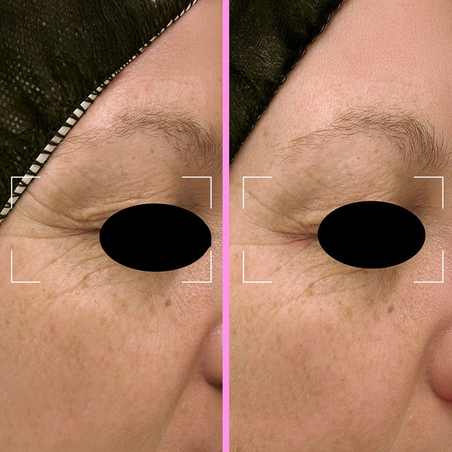 Repair kapsler - Regenererende serum beriget med niacinamid, fotolyase