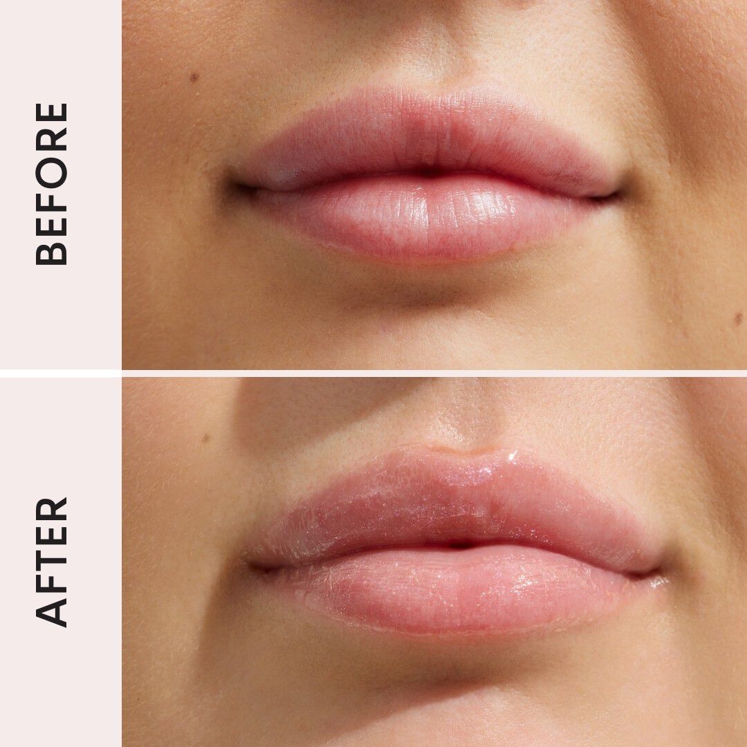 Lip Filler Crystal