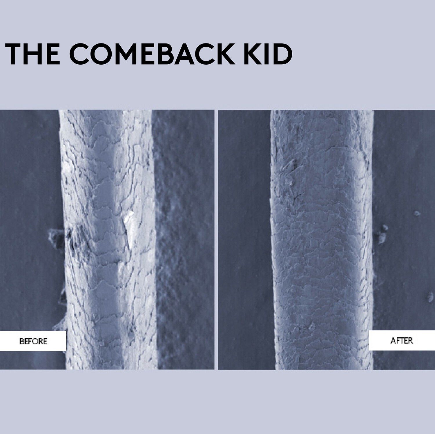 The Comeback Kid -Omg&aring;ende reparerende pleje