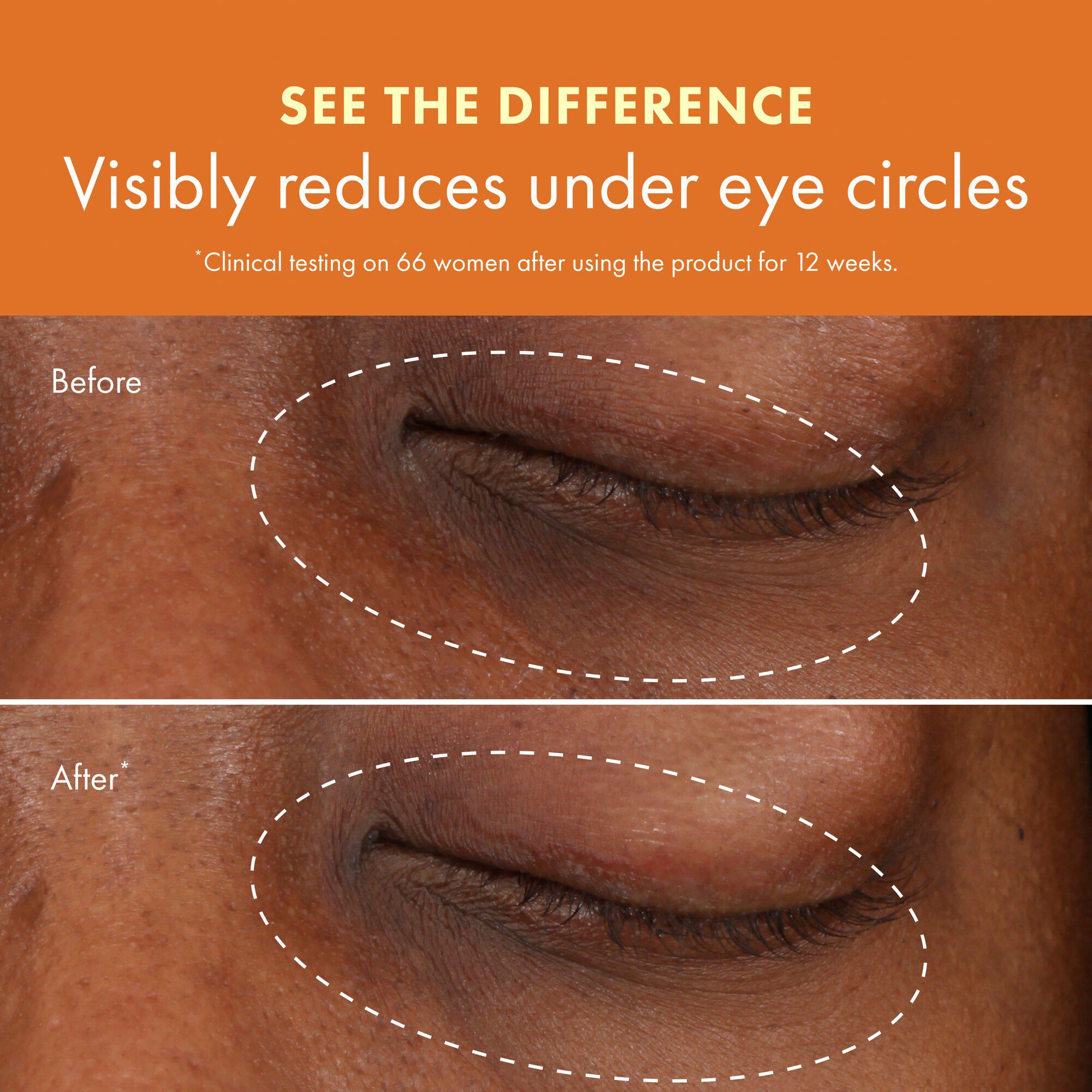 Ginzing Brightening Eye Cream Warm